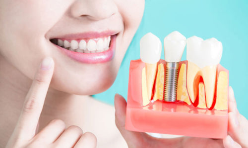 Extracciones dentales modernas