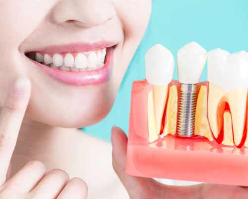 Extracciones dentales modernas